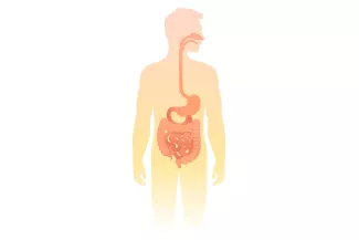 Fisteln bei Morbus Crohn