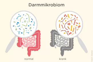 Vergleich normales Mikrobiom vs. krankes Darmmikrobiom bei CED