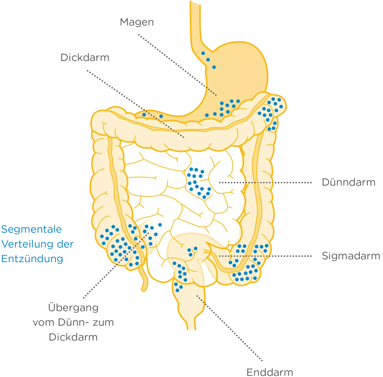 Morbus Crohn - Diagnose Bewegung