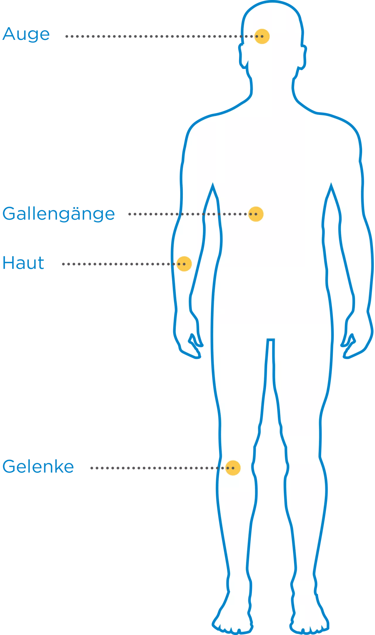 Morbus Crohn Folgen - Silhouette