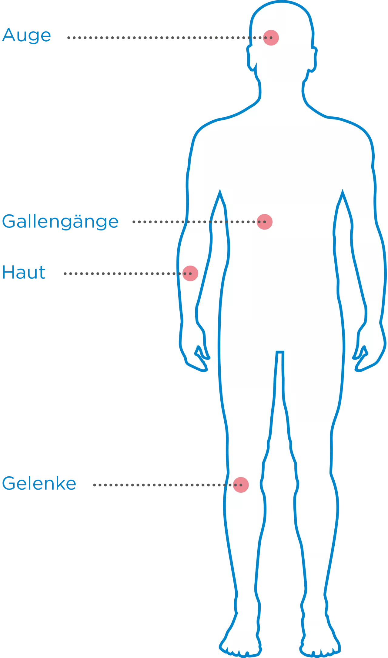 Colitis ulcerosa Folgen - Silhouette